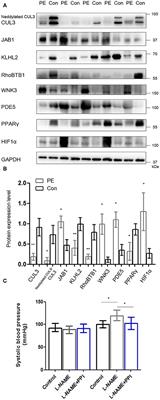 Downregulation of Cullin 3 Ligase Signaling Pathways Contributes to Hypertension in Preeclampsia